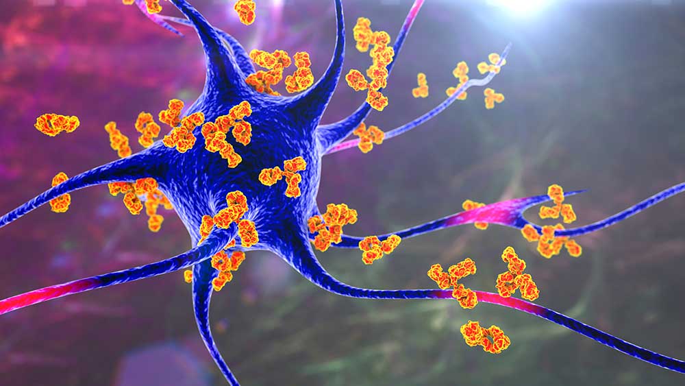 What Are Autoimmune Disorders?